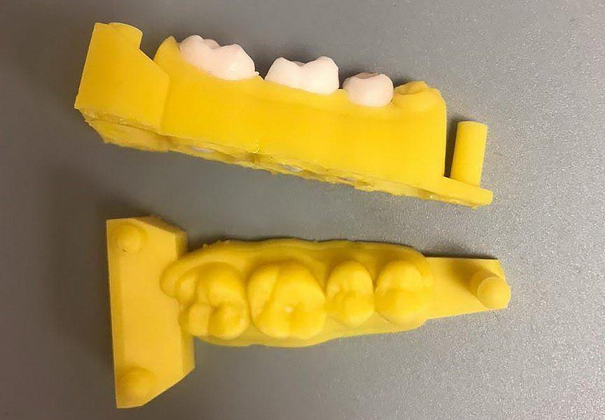 зубы